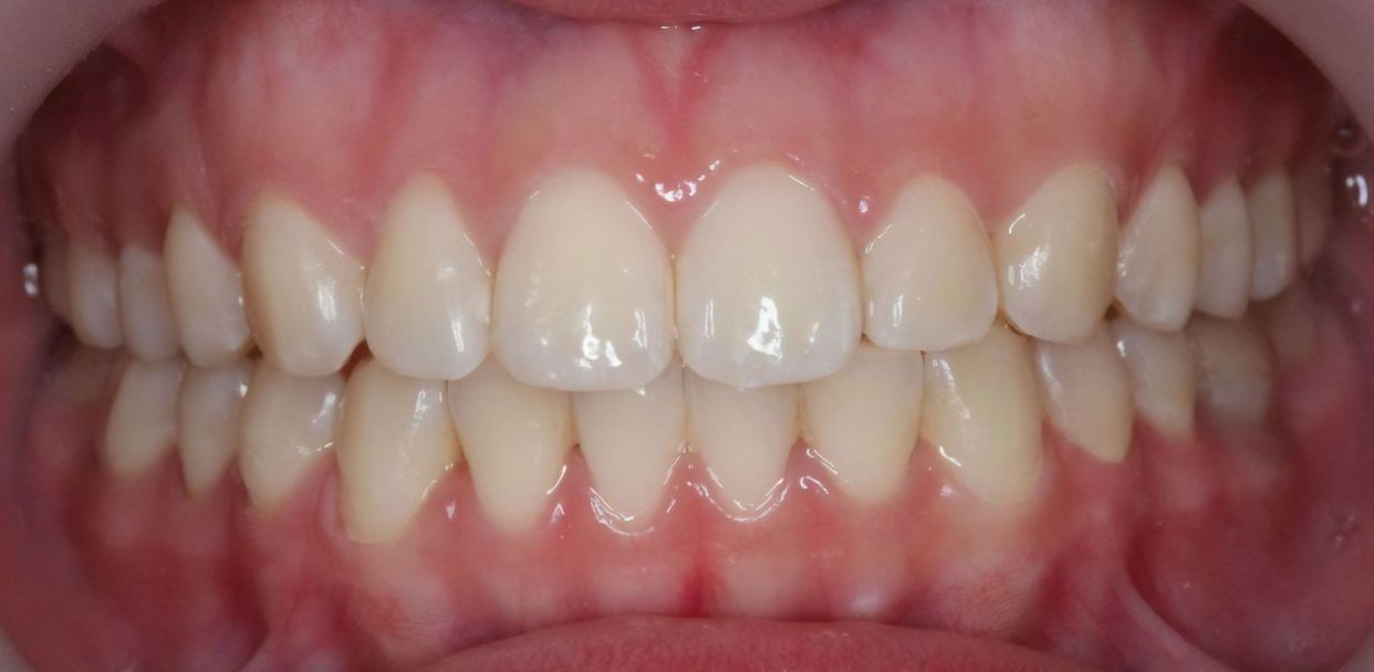 Clinical case — after treatment