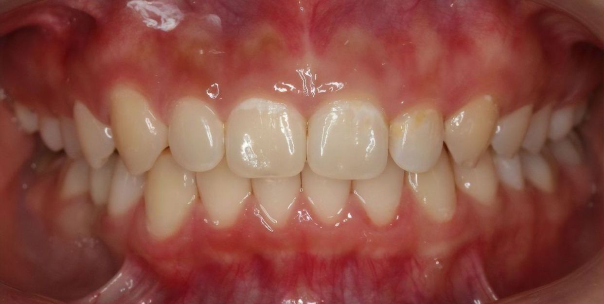 Clinical case — after treatment