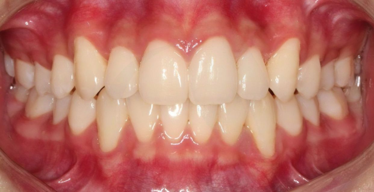 Clinical case — after treatment