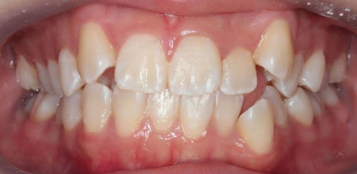 Clinical case — before treatment