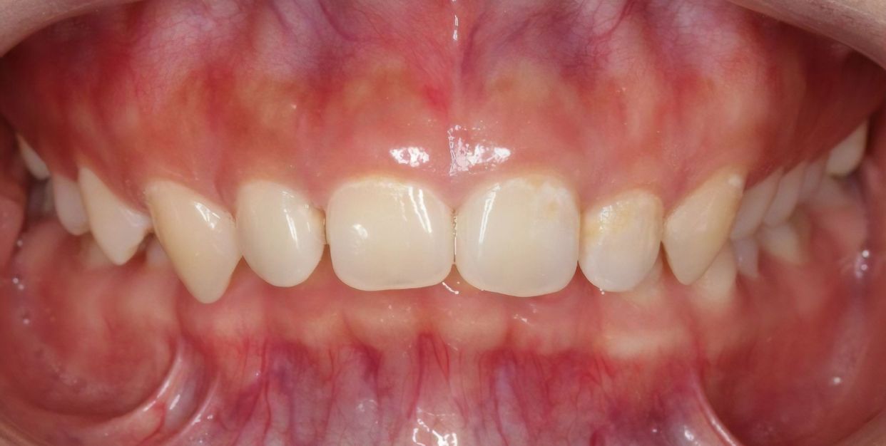 Clinical case — before treatment