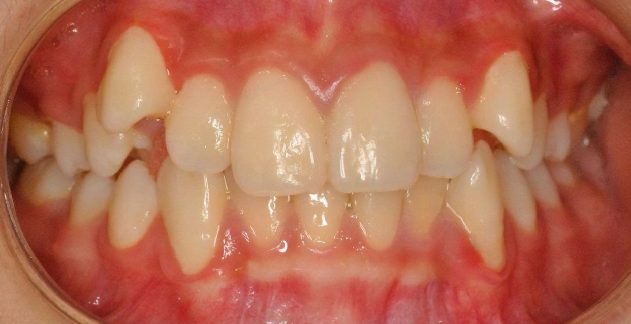 Clinical case — before treatment