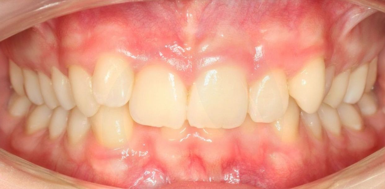Clinical case — before treatment