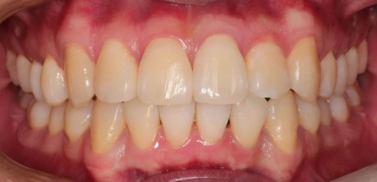 Clinical case — after treatment