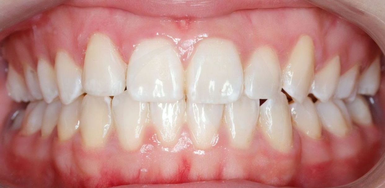 Clinical case — after treatment