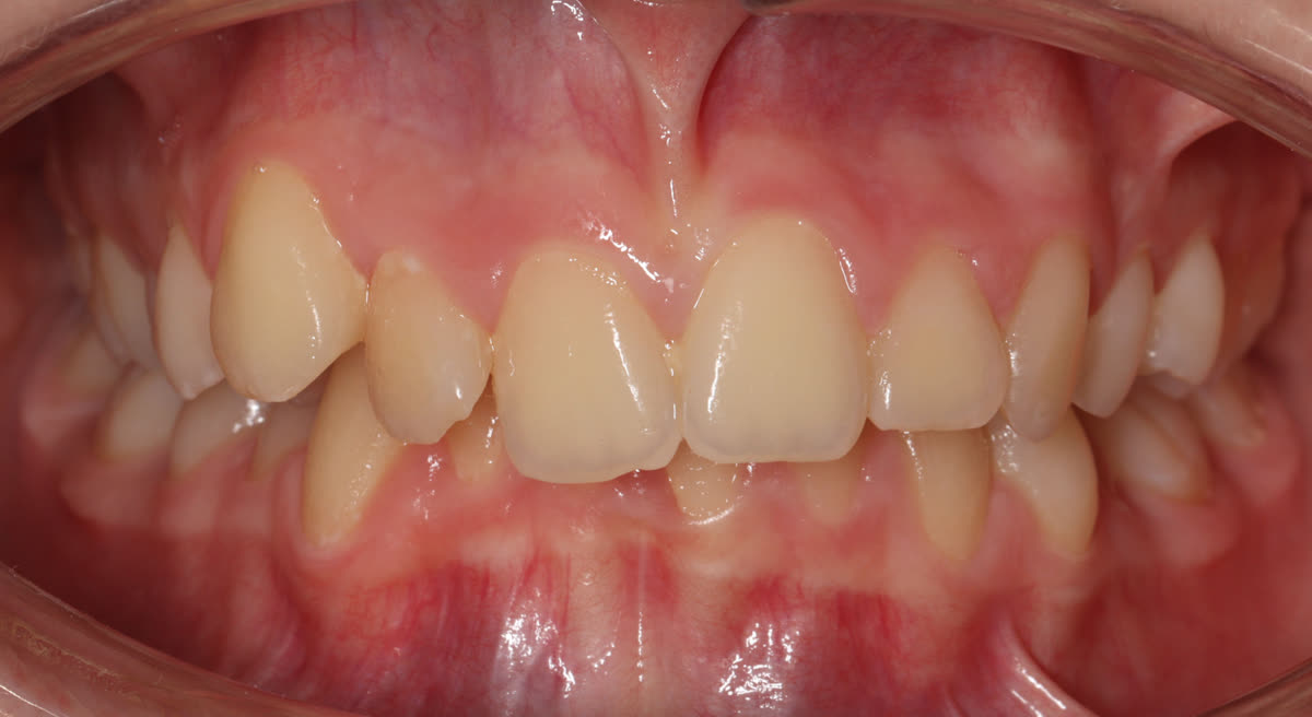 Clinical case #2. Before treatment