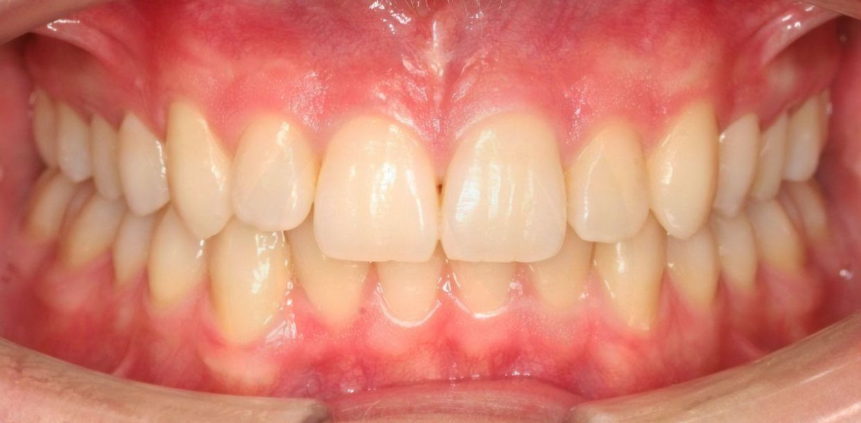 Clinical case — after treatment