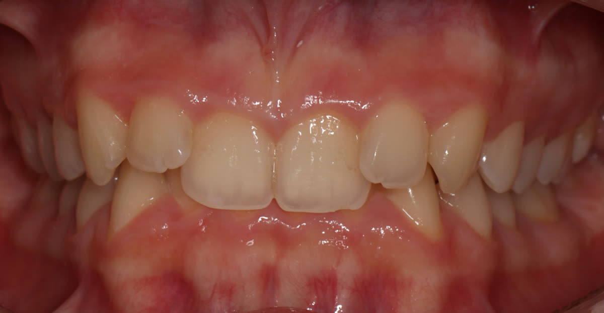 Clinical case #1. Before treatment