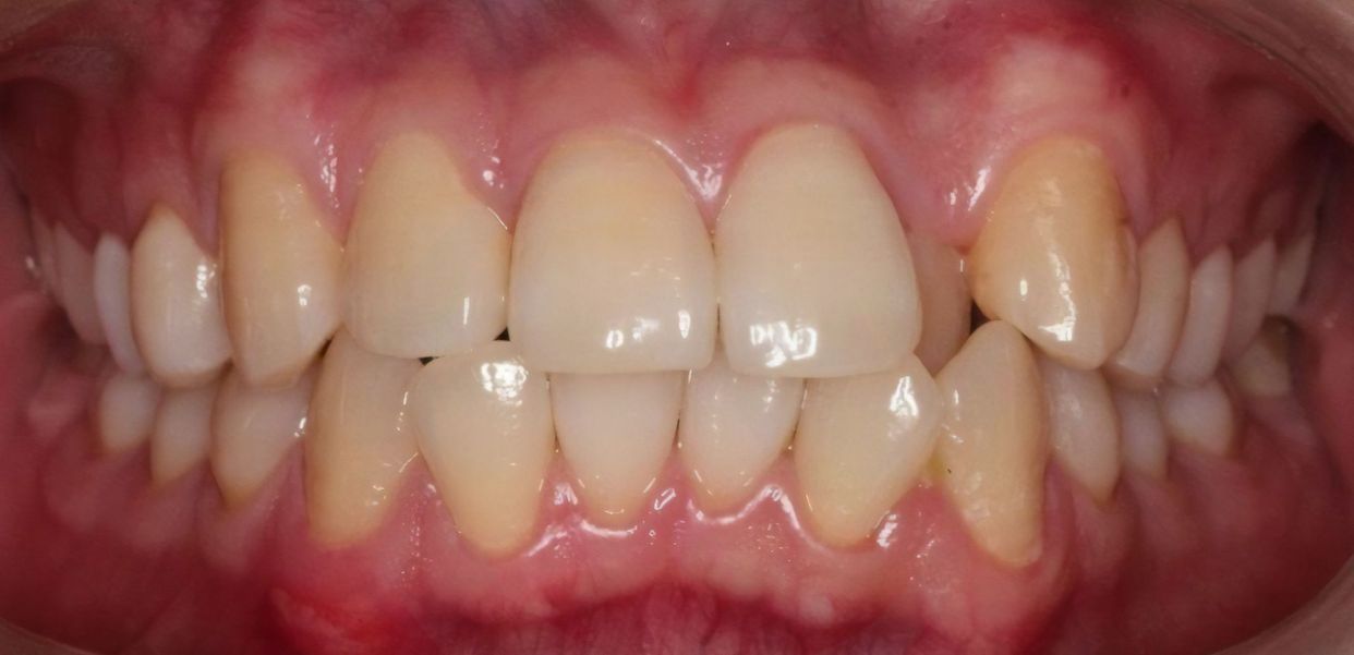 Clinical case — before treatment