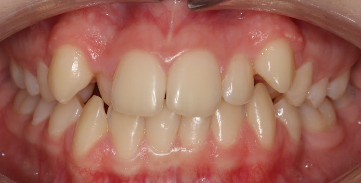 Clinical case #3. Before treatment
